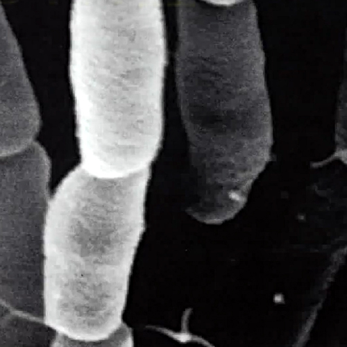 OYK菌の画像