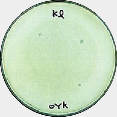 OYK菌上に培養　肺炎桿菌