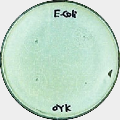 OYK菌上に培養　大腸菌O-157