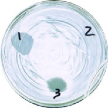 OYK菌体生成物が、大腸菌O-157に抗菌活性を示している。