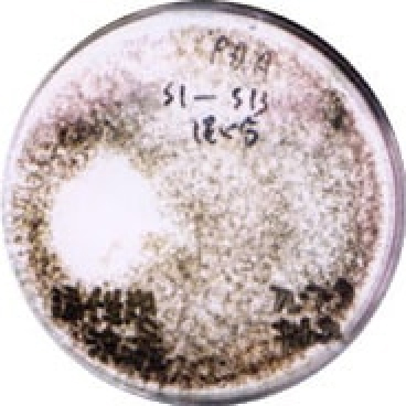 OYK菌が、植物感染カビのフザリウムに拮抗作用を示している。